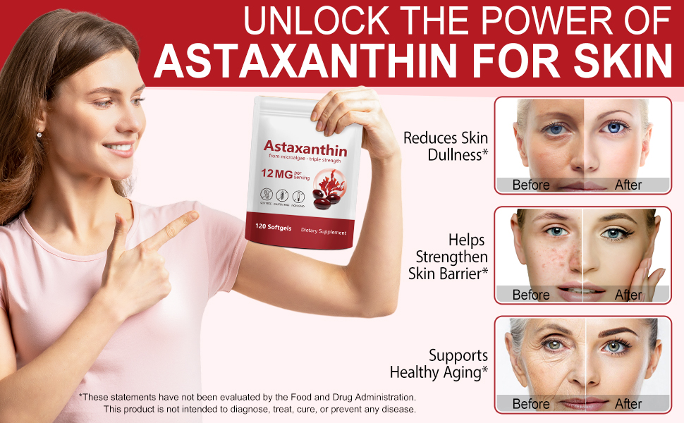 Xaarty Premium Astaxanthin 12mg, Antioxidant Supplement for Eye, Joint, Skin Health,Microalgae Source, 4 Month Supply | Supports Internal Circulation, 120 Softgels