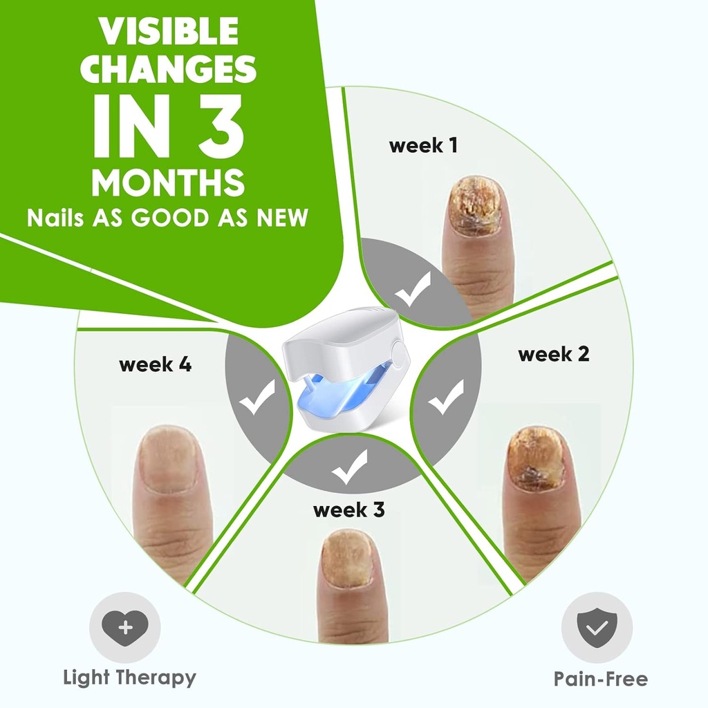 nail-fungus-light-for-toenails-highly-ef-2.jpg