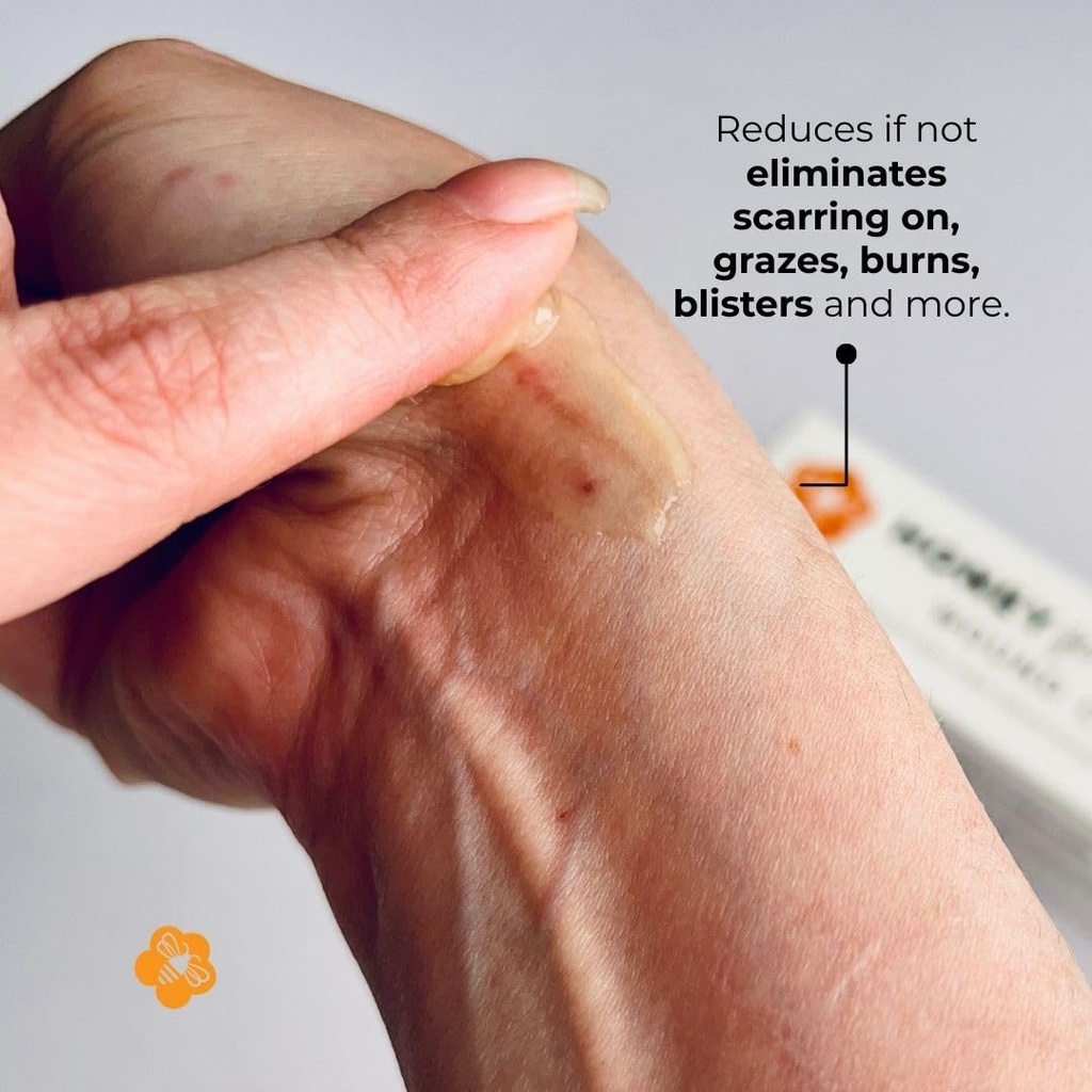 manuka-honey-wound-cream-non-sticky-fast-61Oq1oqNRTL.jpg