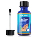 Tratamento de Fungos de unhas - Tratamento de Fungos de unhas para unhas - Tratamento de Fungos de unhas - Tratamento de Fungos de unhas (30ml)