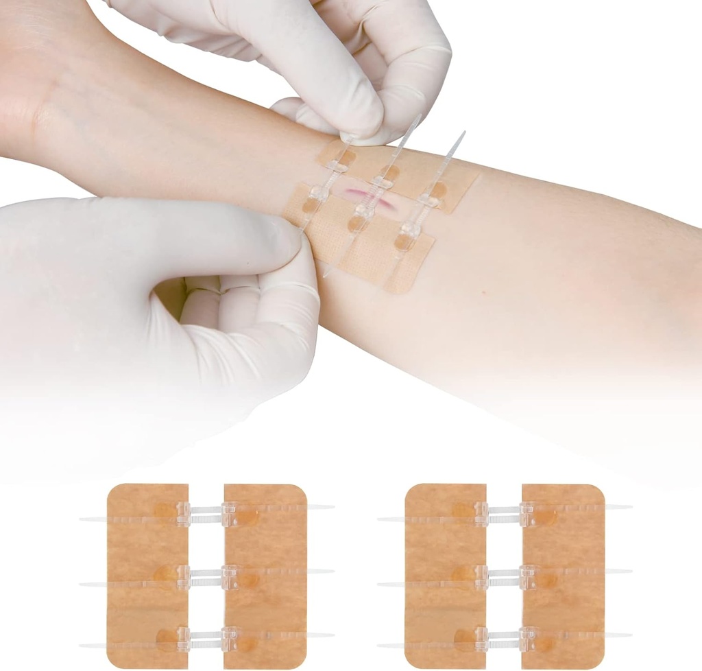 Laceração Zip Stitch Reparo sem Pontos Bandaids Borboleta Clot rápido - Encerramento de Ferimento de Emergência Dispositivo 2 Peças (PU)
