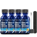 4Pcs Tratamento de Fungos de unhas, 25% de ácido undecilênico, Tratamento de Fungos de unhas para unhas do pé, Tratamentos de Fungos de unhas do pé (2 FL OZ)