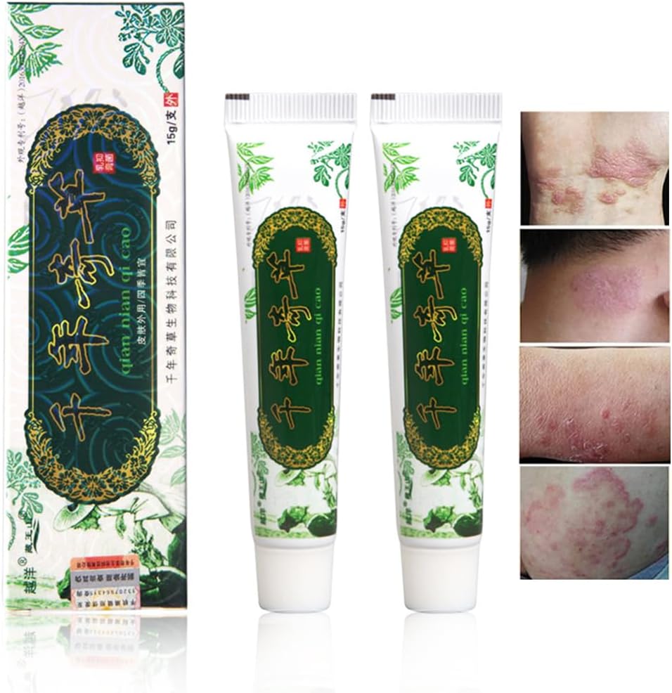 Oversea Thousand-year Herbal Cream Chinese Herbal Eczema, Psoríase Cremes Dermatite e Eczema Pruritus Psoríase JIULIN Pomada (2PCS)