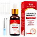 Tratamentos de Fungos de unhas do dedo do pé para unhas: Tratamento de Fungos de unhas para unhas – Extra força, solução de ação rápida para unhas rachadas, danificadas, descoloridas