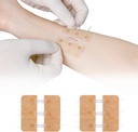 Laceração Zip Stitch Reparo sem Pontos Bandaids Borboleta Clot rápido - Encerramento de Ferimento de Emergência Dispositivo 2 Peças (PU)