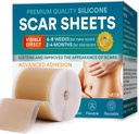 Folhas de Silicone Cicatriz, Fita de Silicone Cicatriz (1,6"x 120" Roll-300CM), Fita de Silicone para Cicatrizes, Fita de Cicatriz para C-Seção, Tuck de barriga, Kelóide e Cicatrizes Cirúrgicas