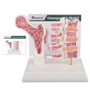 Modelo de Osteoporose de Anatomia Humana Ultrassista, Modelo Anatômico de Esqueleto Vertebras com Cartão de Estudo para Demonstração de Ensino de Estudantes de Medicina