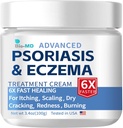 Bio-MD Psoríase Eczema Creme, Creme de Eczema para Adultos, Reocorrência de Controle de Força Extra, Sintoma Aliviador de Resistente, Eficaz para Dermatite Seborreica, Tratamento de Foliculite