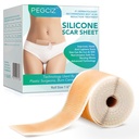 Silicone Scar Sheets, Silicone Scar Tape, Silicone Sheets for Scars, Scar Away Silicone Scar Sheets for Face, Acne, Keloid, Burns, Stretch Mark, C-Seção Cirúrgica Scars Removal (1,6" x 60"Roll-1,5M)