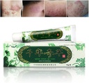 Oversea Thousand-year Herbal Cream Chinese Herbal Eczema, Psoríase Cremes Dermatite e Eczema Pruritus Psoríase JIULIN Pomada