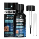Tratamento de Fungos de unhas, Tratamento de Fungos de unhas para unhas, Solução de reparo de unhas, Líquido de renovação de unhas para unhas danificadas e descoloração, Tratamento de Fungos de unhas, segura e suavemente - 30ML (1 FLOZ)