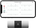 AliveCor KardiaMobile 6-Lead Personal ECG Monitor – Seis Vistas do Coração – Detecta AFib e Arritmias Irregulares – Resultados instantâneos em 30 segundos – Funciona com a maioria dos Smartphones