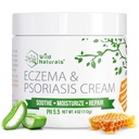 Naturales Selvagens Eczema & Psoríase Creme para Pele Seca, Comichão – Eczema Alivio para Adultos e Crianças – Creme de Psoríase Hidratante com Manuka Mel