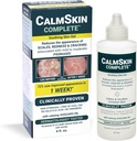 Xenna CalmSkin Complete () Clinicamente provado para acalmar a pele irritada e melhorar a aparência da pele com Psoríase leve a moderada () Made in The USA () 4 fl. oz.