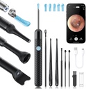 Loyker X6 Ear Wax Removal Tool Camera, Limpador de ouvido com câmera, FSA - HSA Store Elegível, Câmera de ouvido 1080P com 6LED Light para Ear/Nose/Garganta / Tomsil Stone Examination, Preto