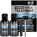 Tratamento de Fungos de unhas 2pcs extra força x 30ml, Tratamento de unhas de fungos de fungos de unhas para unhas, Tratamento de fungos de unhas de pés força extra para unhas danificadas e descoloração.