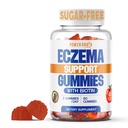 Eczema livre de açúcar gomas de tratamento - EUA Made - 50+ Vitaminas e Probióticos para clara, hidratada pele - acalma coceira, acalma vermelhidão e aumenta a saúde da pele (60 chicletes)
